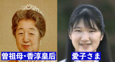 画像比較 愛子さま歯列矯正と初メイクで綺麗顔に 年分時系列まとめ