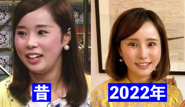 馬場ももこの顔が変わる整形前と最新の顔