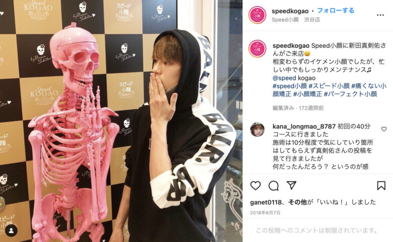 スピード小顔